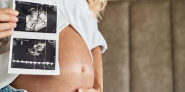 Tweelingzwangerschap: dit kun je verwachten