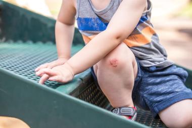 Snij- of schaafwond bij je kind: wat doe je?