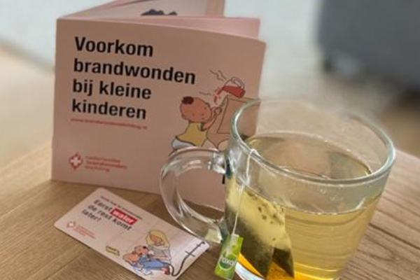 Tips van de Nederlandse Brandwondenstichting Tips van de Nederlandse Brandwondenstichting