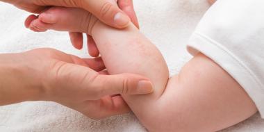 Hoe herken je een allergie bij je baby?