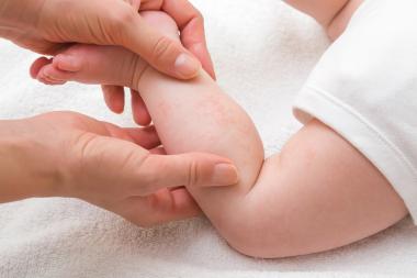 Zo herken je een allergie bij je baby