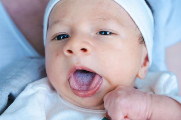 spruw bij je baby spruw bij je baby