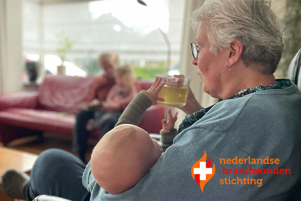 Tips van de Nederlandse Brandwondenstichting Tips van de Nederlandse Brandwondenstichting