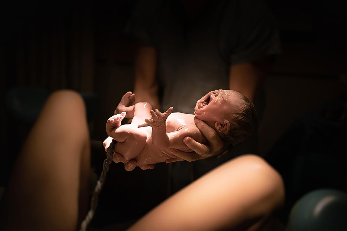 De baby van Lieke en Bastiaan heeft een aangeboren hartafwijking