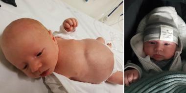 Renske na haar bevalling: â€˜Ik voelde dat het mis was, Mika poepte niet en zijn buikje werd bollerâ€™