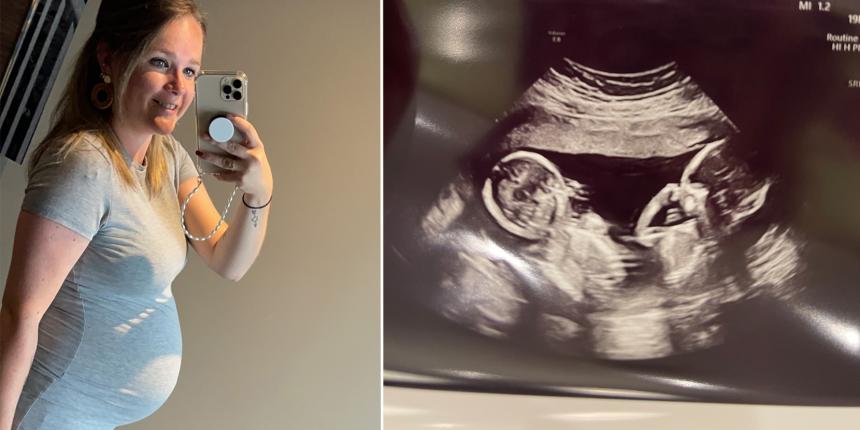 Danouk raakte na 2,5 jaar zwanger van een tweeling dankzij ICSI