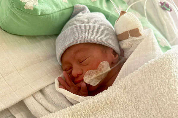 prematuur-31-weken prematuur-31-weken