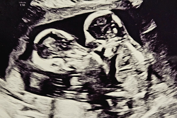 echo-mono-mono-tweeling