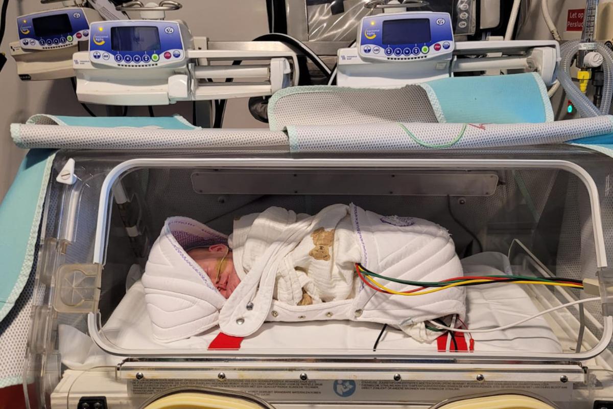 Kimberley’s mono-mono tweeling (deel 2): ‘Ik voelde me schuldig’